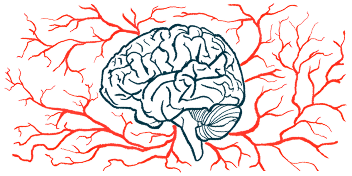 Blood vessels surround a brain.