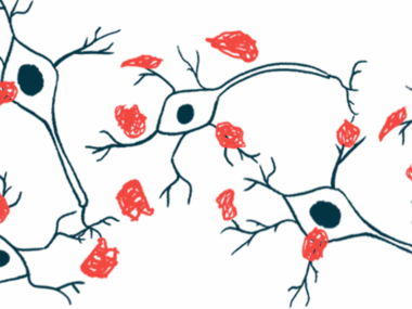 An illustration shows a close-up view of alpha-synuclein protein clumps.
