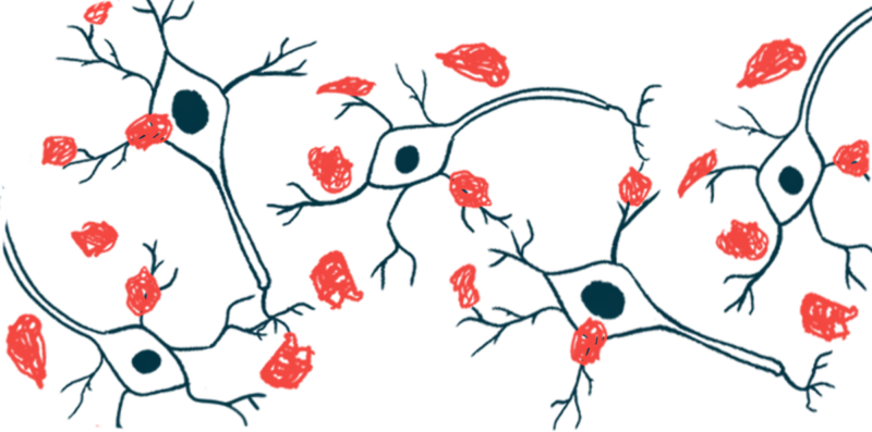 An illustration shows a close-up view of alpha-synuclein protein clumps.