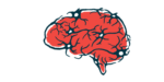 An illustration shows the outline of a brain.