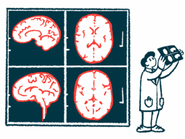 Images from a brain scan are projected on a wall next to a researcher who reviews a copy of them.