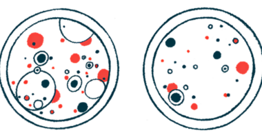 Samples are shown in two petri dishes.