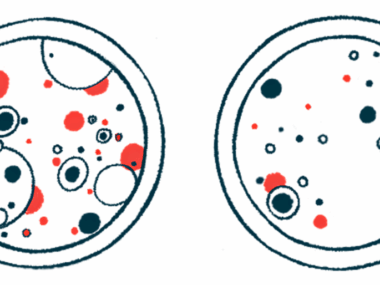 Samples are shown in two petri dishes.