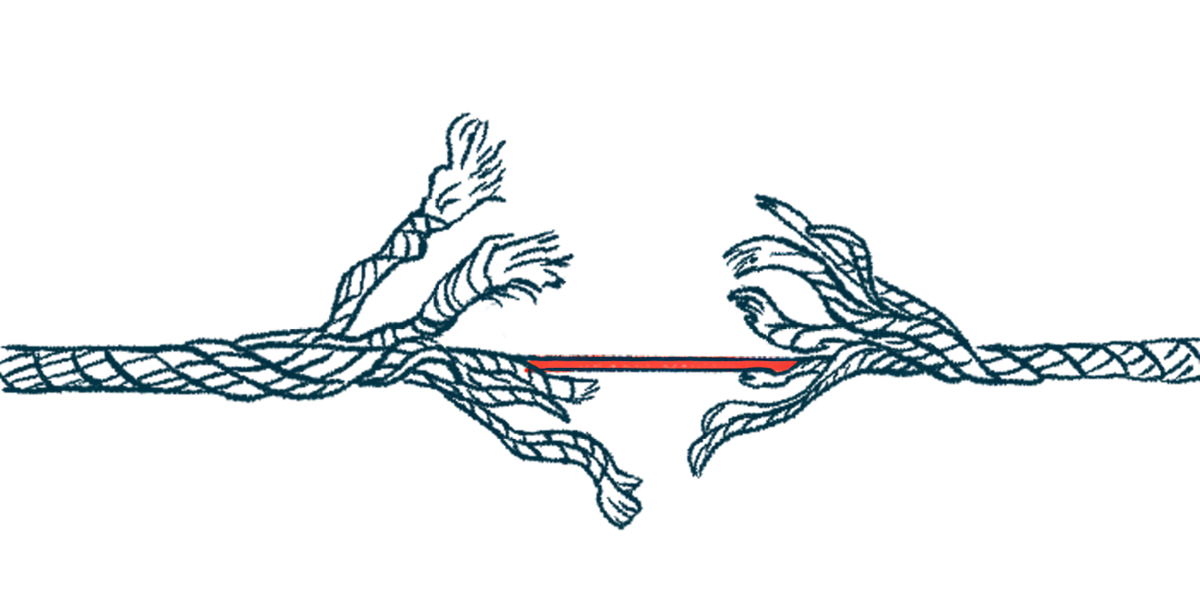 Illustration of a fraying rope breaking apart at the center.
