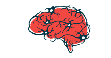 Illustration of a human brain in red with dark branching blood vessels.