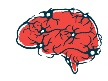 Illustration of a human brain in red with dark branching blood vessels.