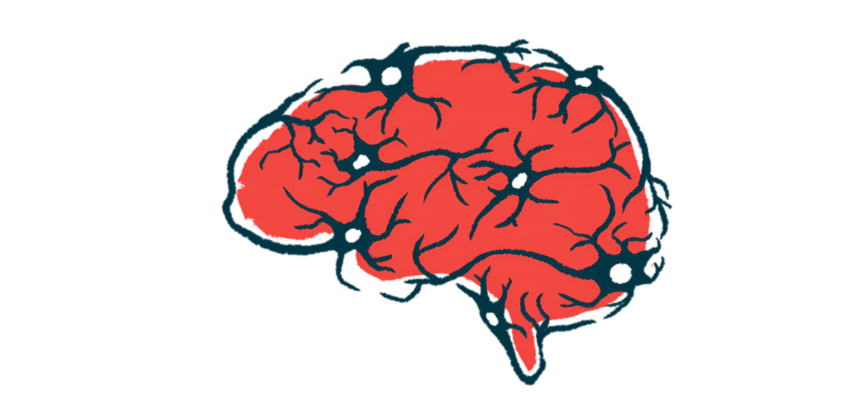 Illustration of a human brain in red with dark branching blood vessels.